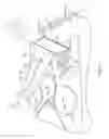 Fig. 06 - BLOOD CLUCOSE MANAGEMENT SYSTEM