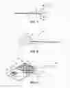 Fig. 06 - LANCET DEVICE WITH FLEXIBLE COVER
