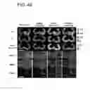Fig. 43 - SYSTEM AND METHOD FOR MULTI-MODALITY QUANTIFICATION OF NEUROINFLAMMATION IN CENTRAL NERVOUS SYSTEM DISEASES