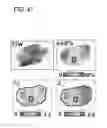 Fig. 46 - SYSTEM AND METHOD FOR MULTI-MODALITY QUANTIFICATION OF NEUROINFLAMMATION IN CENTRAL NERVOUS SYSTEM DISEASES
