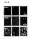 Fig. 47 - SYSTEM AND METHOD FOR MULTI-MODALITY QUANTIFICATION OF NEUROINFLAMMATION IN CENTRAL NERVOUS SYSTEM DISEASES