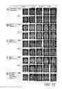 Fig. 52 - SYSTEM AND METHOD FOR MULTI-MODALITY QUANTIFICATION OF NEUROINFLAMMATION IN CENTRAL NERVOUS SYSTEM DISEASES