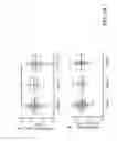 Fig. 55 - SYSTEM AND METHOD FOR MULTI-MODALITY QUANTIFICATION OF NEUROINFLAMMATION IN CENTRAL NERVOUS SYSTEM DISEASES