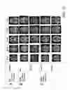 Fig. 58 - SYSTEM AND METHOD FOR MULTI-MODALITY QUANTIFICATION OF NEUROINFLAMMATION IN CENTRAL NERVOUS SYSTEM DISEASES