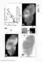 Fig. 74 - SYSTEM AND METHOD FOR MULTI-MODALITY QUANTIFICATION OF NEUROINFLAMMATION IN CENTRAL NERVOUS SYSTEM DISEASES