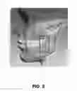 Fig. 06 - Method and apparatus for adjusting technical exposure factors during radiographic acquisition