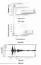 Fig. 30 - IMPLANTS USING ULTRASONIC BACKSCATTER FOR DETECTING ELECTROPHYSIOLOGICAL SIGNALS