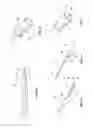 Fig. 03 - Biopsy systems and methods