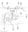 Fig. 02 - Surgical methods of osteotomy device with an In-vitro alignment component