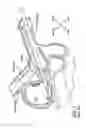 Fig. 02 - Curved resectoscope