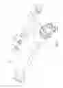 Fig. 03 - Trocar