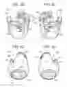 Fig. 06 - Bone anchor assemblies and related instrumentation