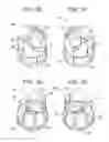 Fig. 09 - Bone anchor assemblies and related instrumentation
