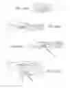 Fig. 09 - Orthopedic compression plate and method of surgery