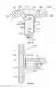 Fig. 07 - Apparatus and method for joint repair