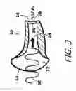Fig. 04 - Sound attenuation earplug system and method of manufacture