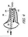 Fig. 05 - Sound attenuation earplug system and method of manufacture