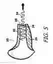Fig. 06 - Sound attenuation earplug system and method of manufacture