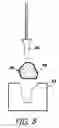 Fig. 09 - Sound attenuation earplug system and method of manufacture