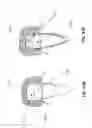 Fig. 33 - Customized fabrication of orthodontic retainers based on patient anatomy