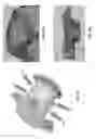 Fig. 34 - Customized fabrication of orthodontic retainers based on patient anatomy