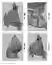 Fig. 35 - Customized fabrication of orthodontic retainers based on patient anatomy