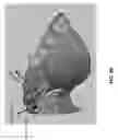 Fig. 40 - Customized fabrication of orthodontic retainers based on patient anatomy