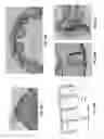 Fig. 44 - Customized fabrication of orthodontic retainers based on patient anatomy
