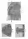 Fig. 45 - Customized fabrication of orthodontic retainers based on patient anatomy
