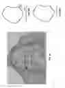 Fig. 46 - Customized fabrication of orthodontic retainers based on patient anatomy