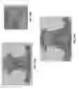 Fig. 47 - Customized fabrication of orthodontic retainers based on patient anatomy
