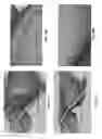 Fig. 52 - Customized fabrication of orthodontic retainers based on patient anatomy