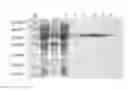 Fig. 01 - Enzyme and application thereof