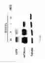 Fig. 07 - COMPOSITIONS COMPRISING PARTICLES AND METHODS FOR TREATING CANCER