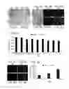 Fig. 11 - COMPOSITIONS COMPRISING PARTICLES AND METHODS FOR TREATING CANCER