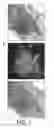 Fig. 02 - Method of fixing and expressing physiologically active substance