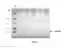 Fig. 06 - Process for extracellular secretion of Brazzein
