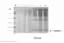 Fig. 07 - Process for extracellular secretion of Brazzein