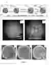 Fig. 02 - Metal nanoshell-coated barcodes