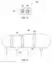 Fig. 06 - Radio frequency (RF) coil array for a magnetic resonance imaging (MRI) system for use in interventional and surgical procedures