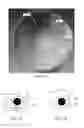 Fig. 06 - Prosthetic lenses and methods of making the same