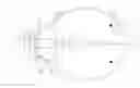 Fig. 01 - MYOPIA CONTROL LENS WITH ASPHERIC SURFACE TO CREATE PERIPHERAL DEFOCUS