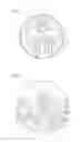 Fig. 02 - Progressive spectacle lens, method of manufacturing a progressive spectacle lens, and method of designing a progressive spectacle lens