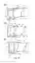 Fig. 83 - Developer supply container and developer supplying system