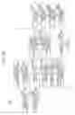 Fig. 85 - Control method and non-transitory computer-readable recording medium for comparing medical images