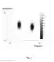 Fig. 05 - Method and apparatus for user guidance for the choice of a two-dimensional angiographic projection