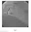 Fig. 06 - Method and apparatus for user guidance for the choice of a two-dimensional angiographic projection