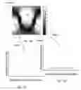 Fig. 17 - Method and apparatus for user guidance for the choice of a two-dimensional angiographic projection