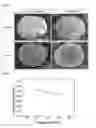 Fig. 02 - CORE-SHELL STRUCTURED COMPOSITE POWDER FOR SOLID OXIDE FUEL CELL