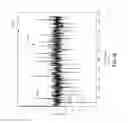 Fig. 37 - Electromagnetic sensing and detection of ingestible event markers